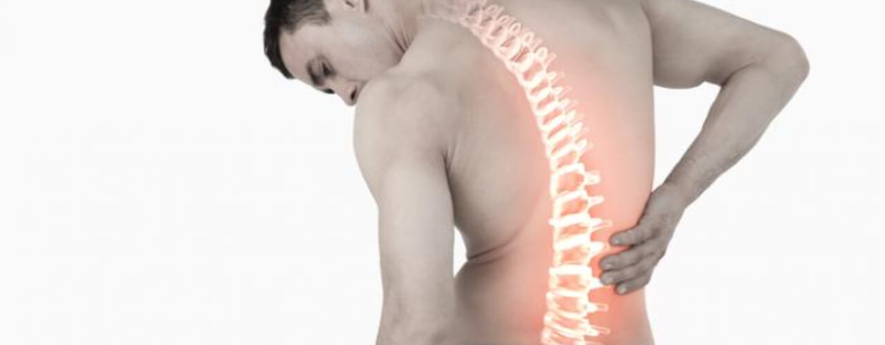 Poor posture causing back pain - posture correction therapy